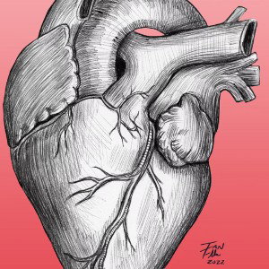 car accident by H