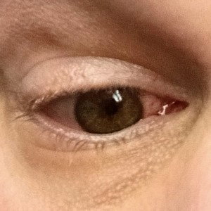 Sleepy Eye 