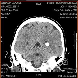 BRAIN CHIPPED BY THE CARTEL MAFIA