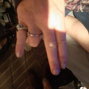 ballad if stink finger part 2