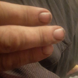 stink finger
