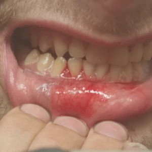 SNARLIN Prod. Ryker Röll