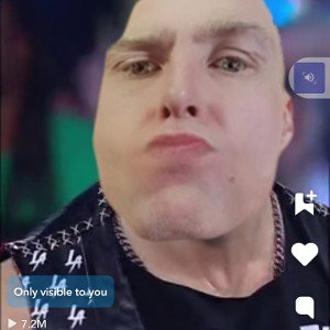 FBRAK ATUDE44