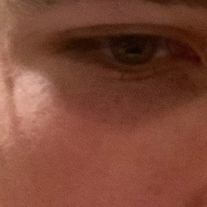 Pain