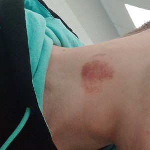 Положил на бит
