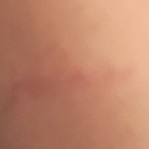 ابره