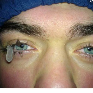 frozen tears