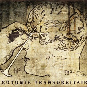 Lobotomi (prod.yigit)