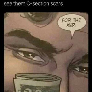 See The Cee Section Scars 
