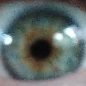 Eye C Problemz