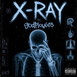 X RAY