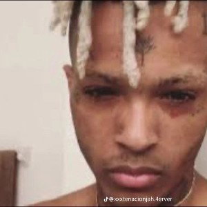 where did you go now FT. @xxxtentacion