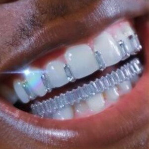 [SOLD] BEAT DRILL "GRILLZ"