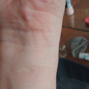 Scars-Lidtekens-Dutch