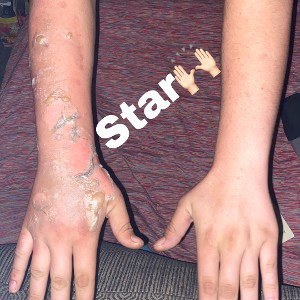 Star