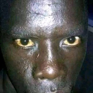 are u poing bro