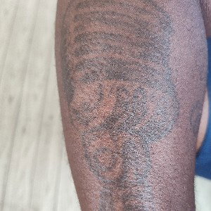 Mic on my arm
