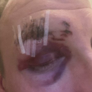 xxx