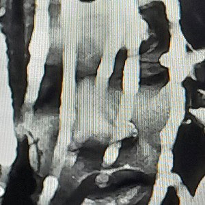 Suicide (Snippet)