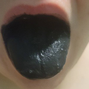ballbagg