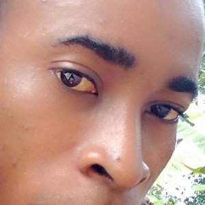 see_my_eyes_red