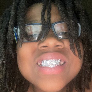 I got Diamond grills in my teeth