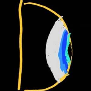 Eye D - BOP