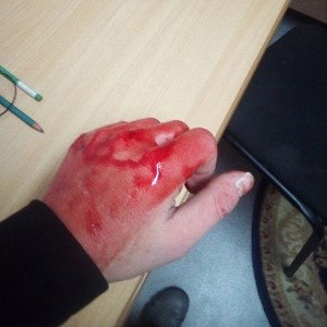 Боль