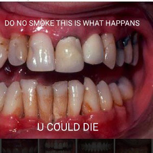 Dont smoke🚬🚬🚬🚬🚬🚬