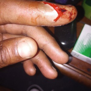 so much pain