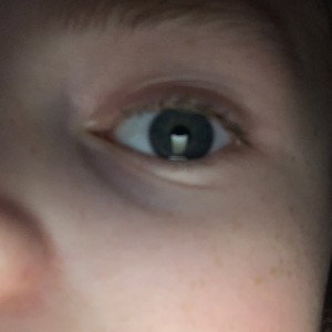 eye