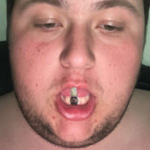F**K You Cheeto(Diss Track)