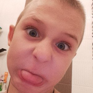 Белые какашки