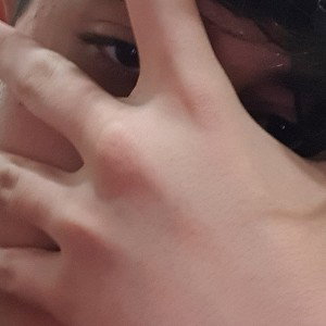 KH