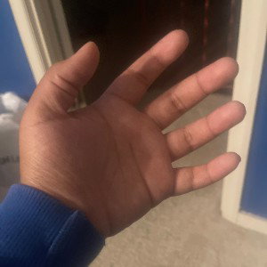 H2H