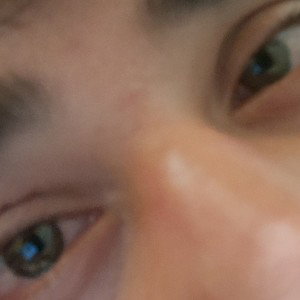 SUDOR DE OJO
