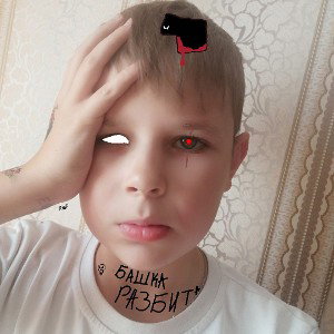 башка разбита