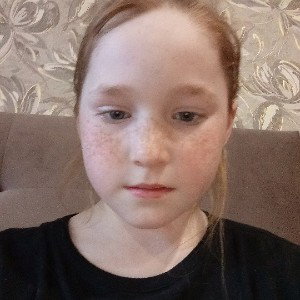 всё я спалила её лицо