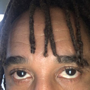 something in my eye