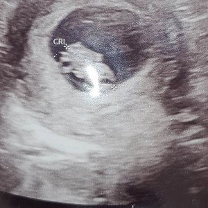 Tyler - money on my mind