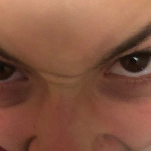 The return of Skinny Penis