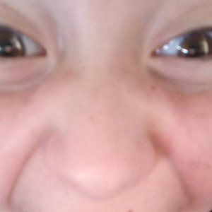 esquizofrenia