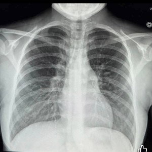 no need for an x-ray 