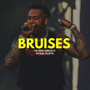 Bruises (09:06:05)