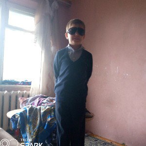 красные глаза 