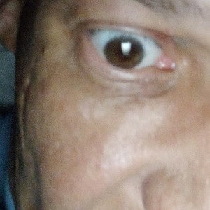 3rdeye