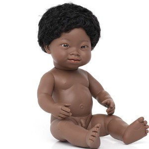 down syndrome baby
