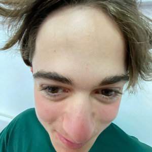 ניתאי צמא