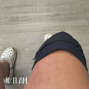 Recovery