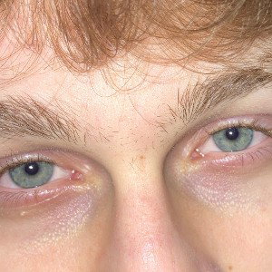 High effect